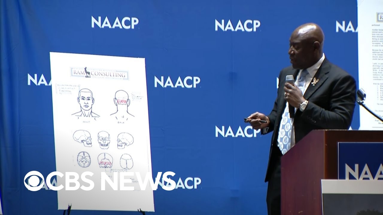 Nolan Wells' preliminary independent autopsy results read by attorney Ben Crump