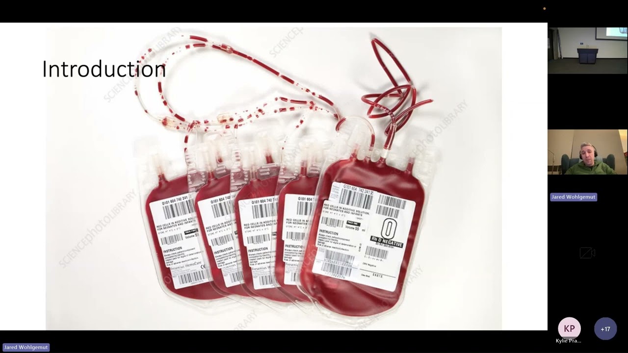 Identification of Major Haemorrhage in Trauma Patients  Jared Wohlgemut