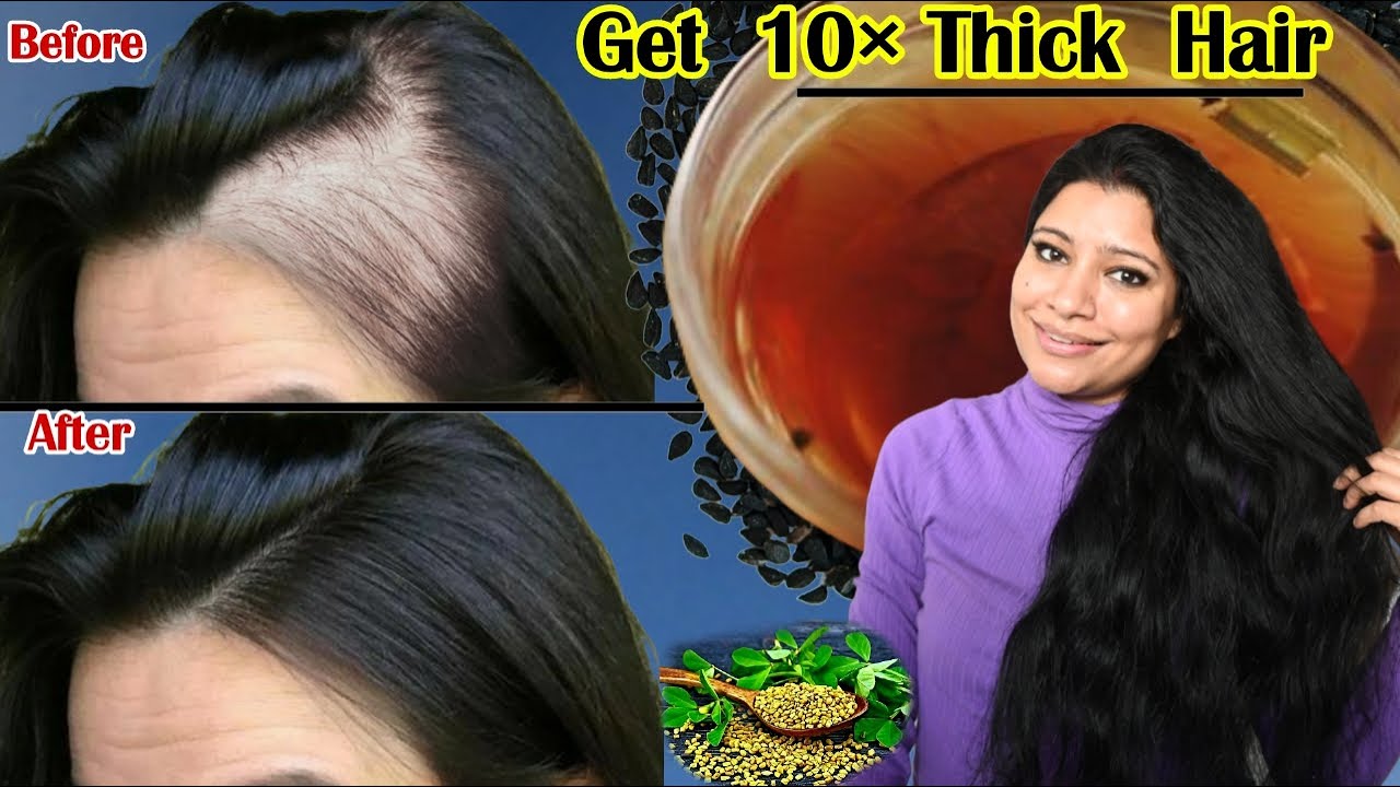 Follow These 2 Steps To Regrow Hair & To Increase Thickness Of Hair ।Garima Singh ।