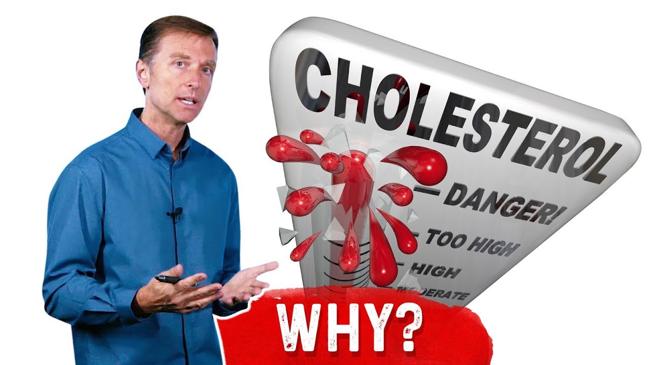Why Do You Get High Cholesterol After Intermittent Fasting? &ndash; Dr.Berg