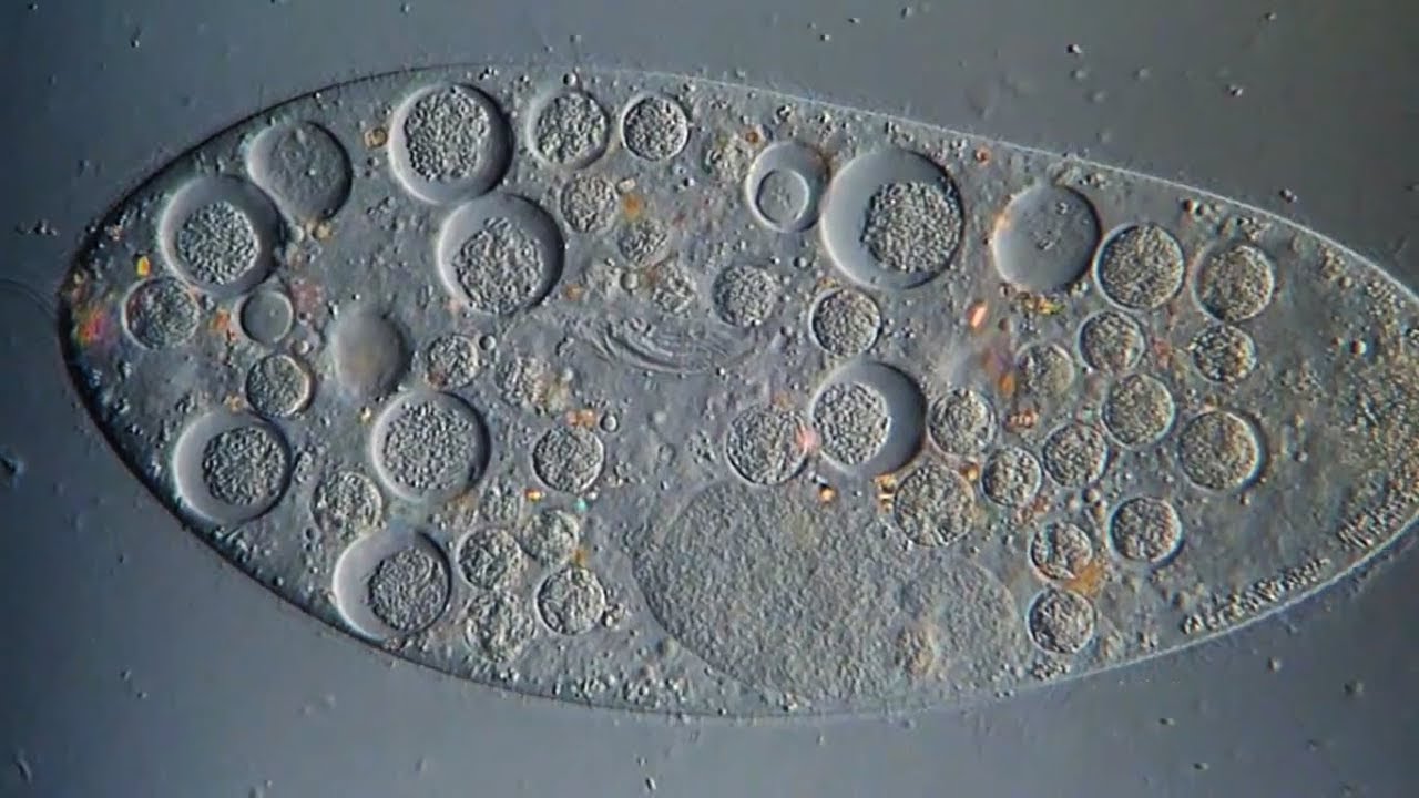 Paramecium Characteristic & Structure | Under The Microscope