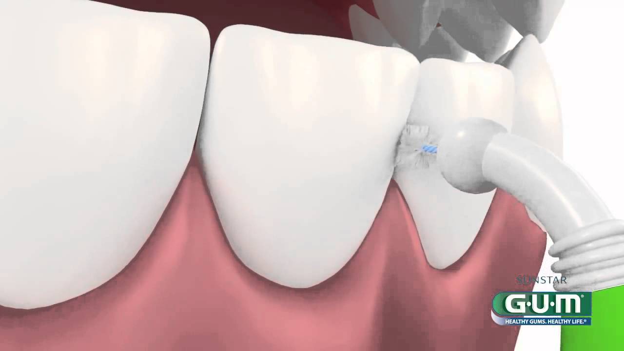 GUM Trav Ler Ragers -  Dental Shop 4 You