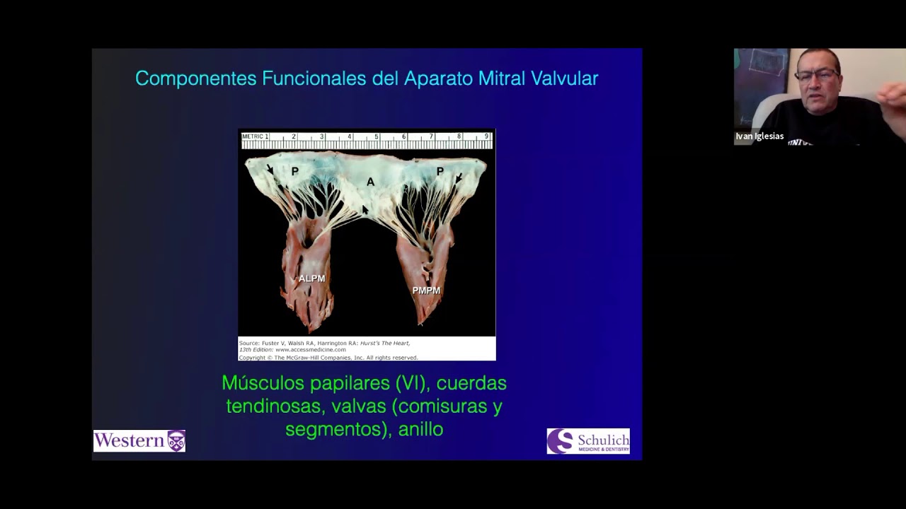 Ecocardiografia de la válvula mitral I. WebinarSmact 9.