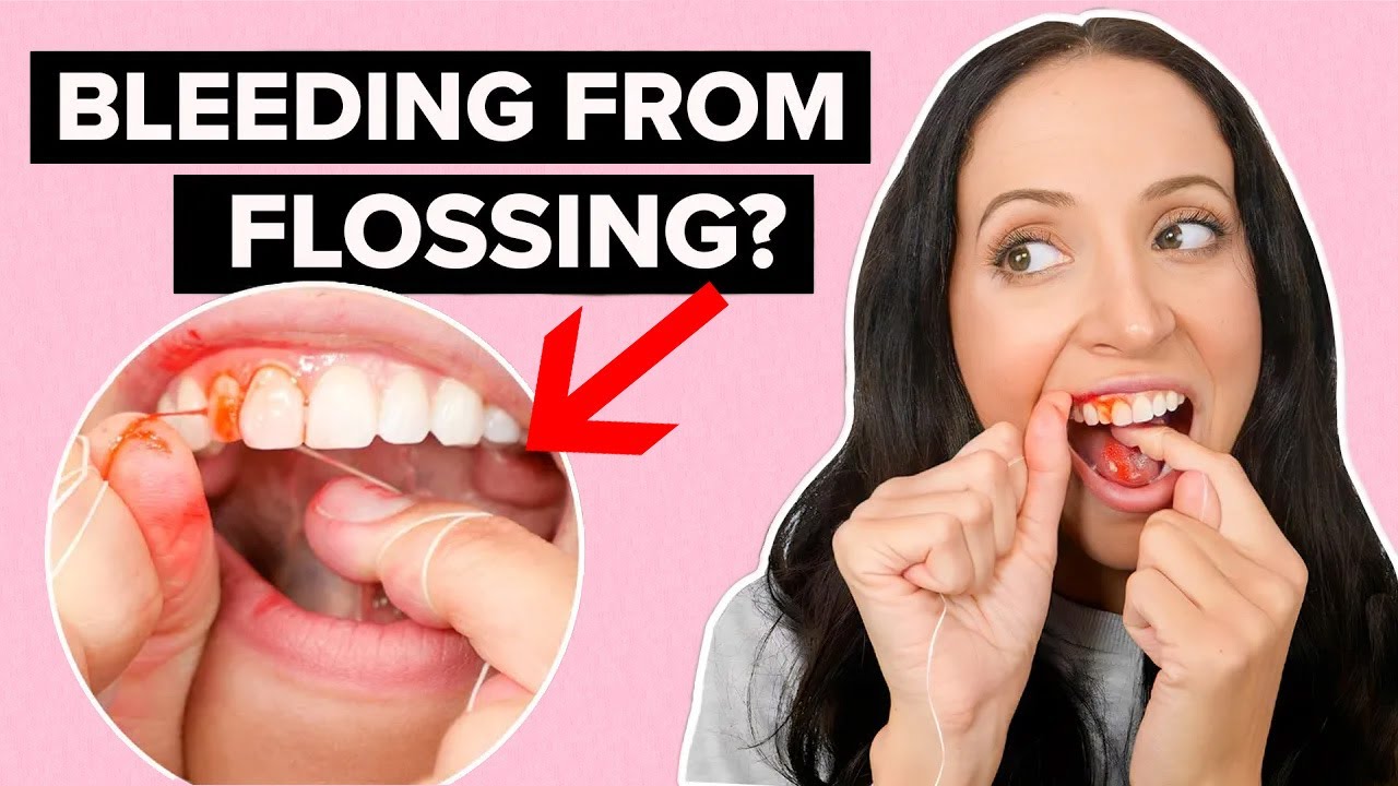 If Your Gums Bleed When You Floss... Watch This Video!