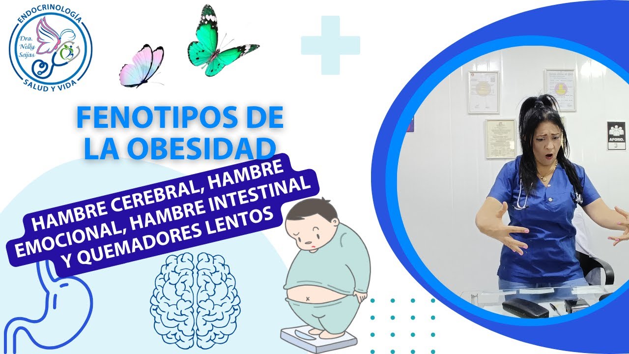 FENOTIPOS DE LA OBESIDAD. Hambre: Cerebral, Intestinal y emocional o quemador lento.
