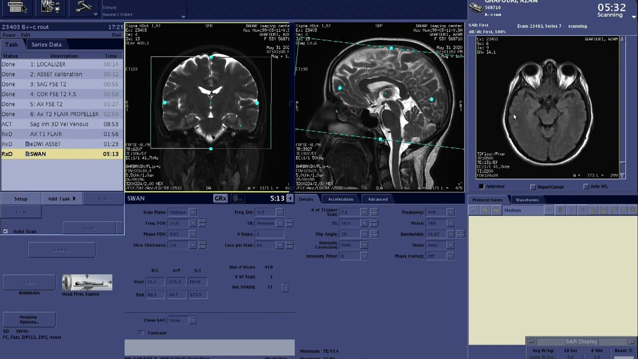 BRAIN MRV Planning with GE Scanner