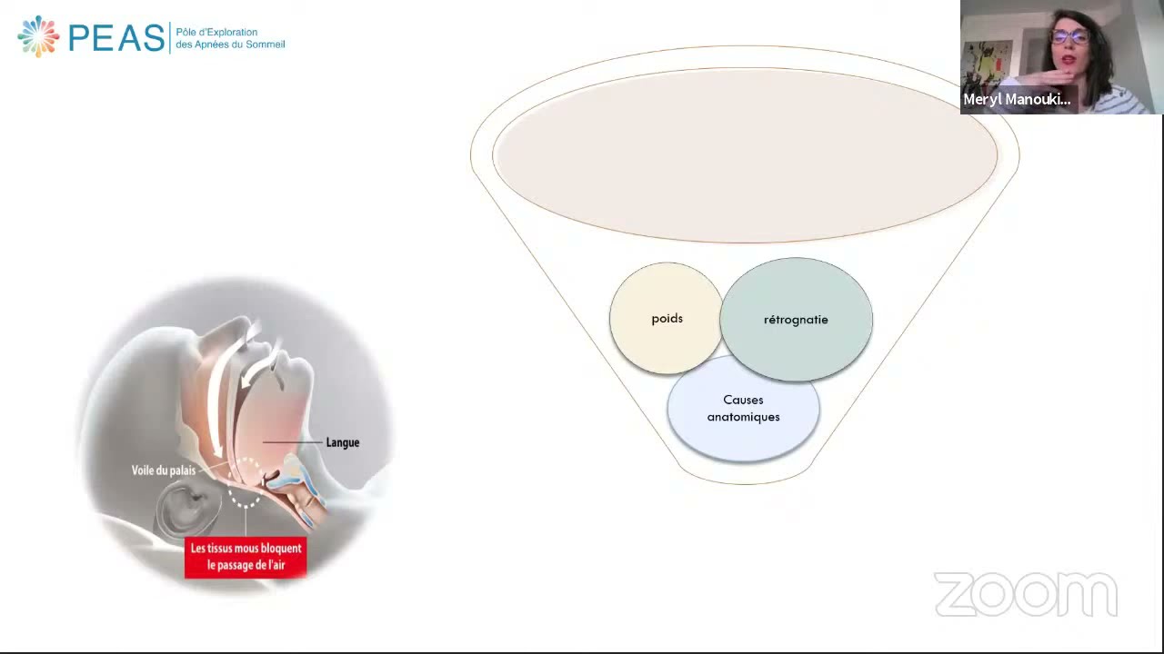 (REPLAY) Webinaire 19 mars 2021 : Apnées du sommeil, des aides pour mieux faire face !