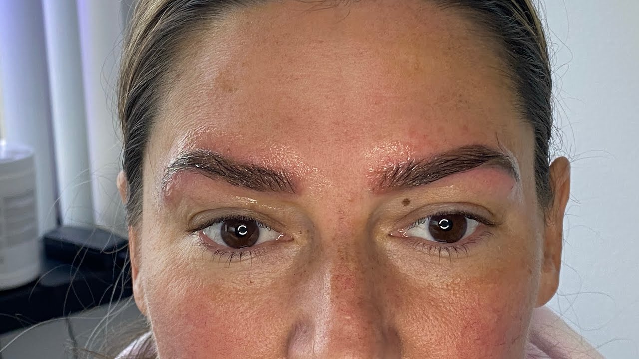 Remove Permanent Brows …Discolored and Misshaped (Li-ft removal)