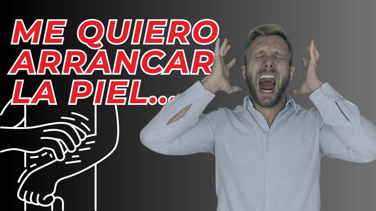 Urticaria por ANSIEDAD &iquest;Debo preocuparme?