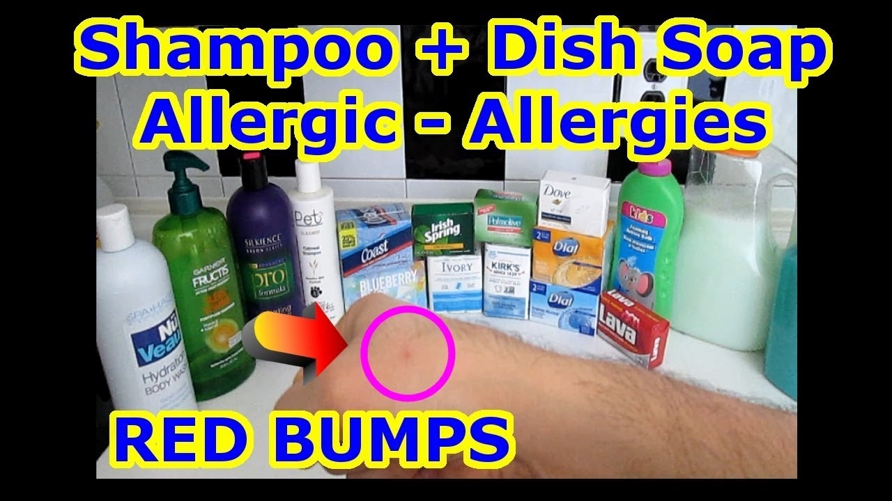 Allergy + Allergic To Shampoo + Dish Soap + Hand + Shower Bath Body Gel + Conditioner = 3 Ingredient