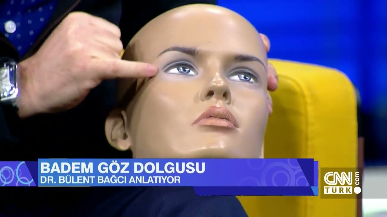 BADEM GÖZ DOLGUSU NASIL YAPILIR? (Çukur göz tedavisi) Uzm.Dr.Bülent Bağcı