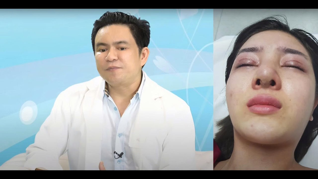 Rhinoplasty Gone Wrong in South Korea - Sharing from Dr. Chiem Quoc Thai