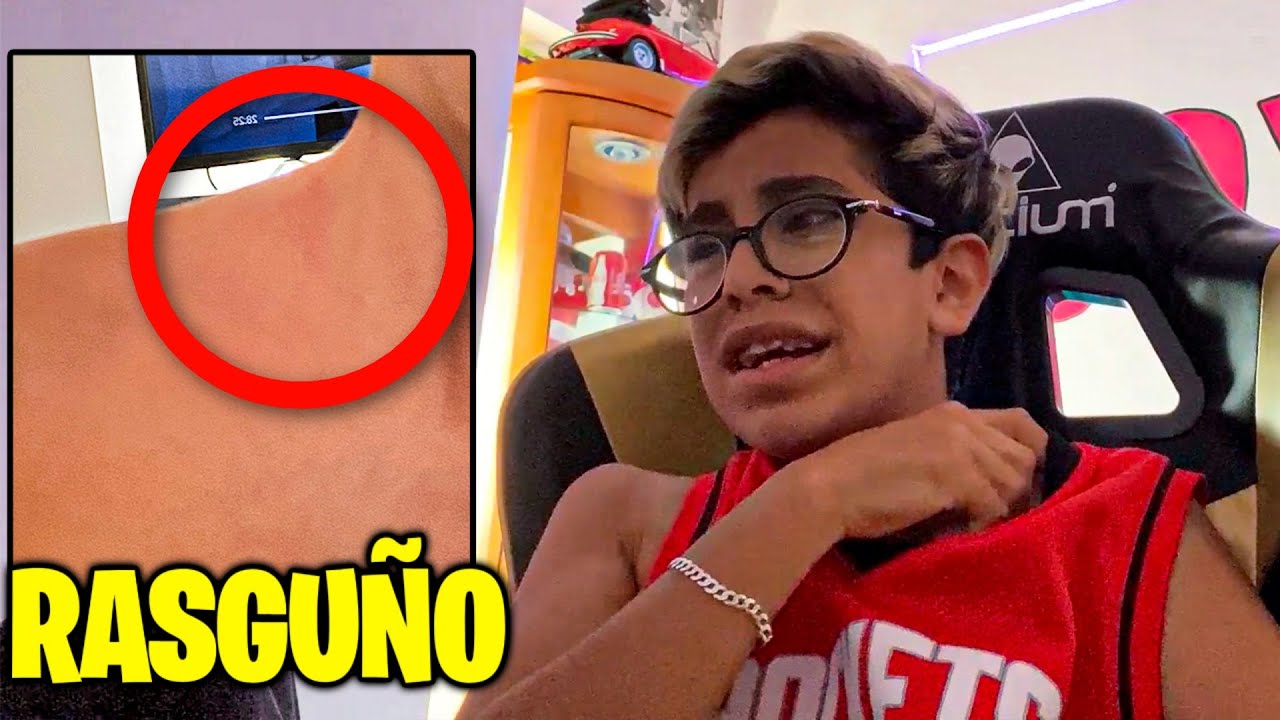Creo que me arañaron en la noche...