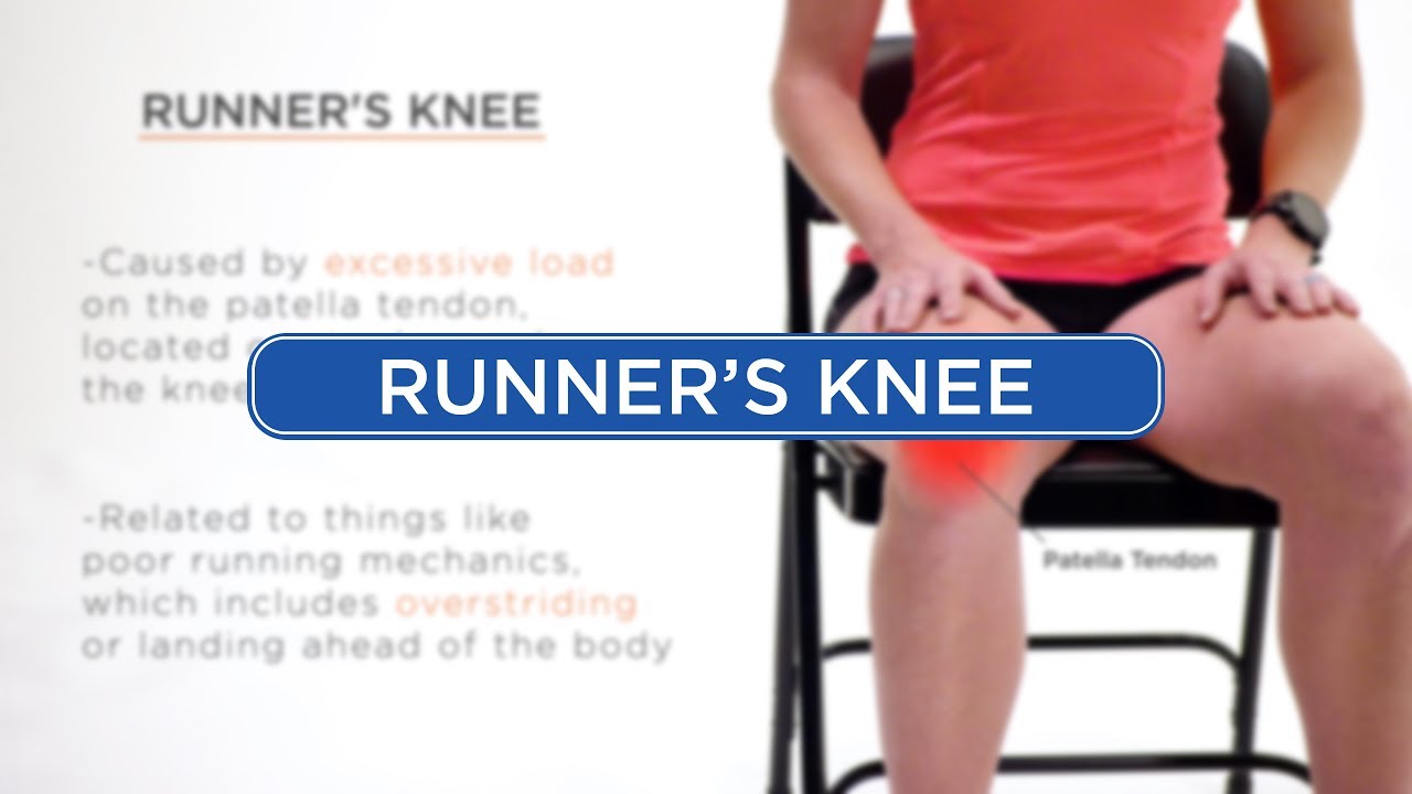 Runner's Knee - Diagnosis
