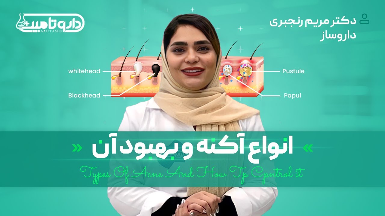انواع جوش و آکنه و بهترین راه تشخیص و شناخت آنها