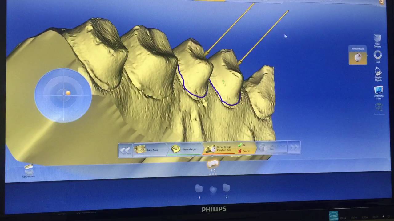 Cerec Redcam 64bit working with inLab 4.2.5 and Exocad 2015