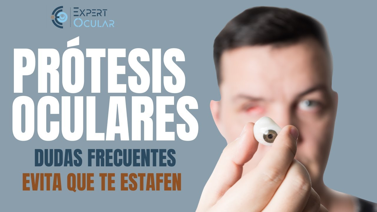 Prótesis Oculares: Dudas Frecuentes y Consejos para Evitar Estafas