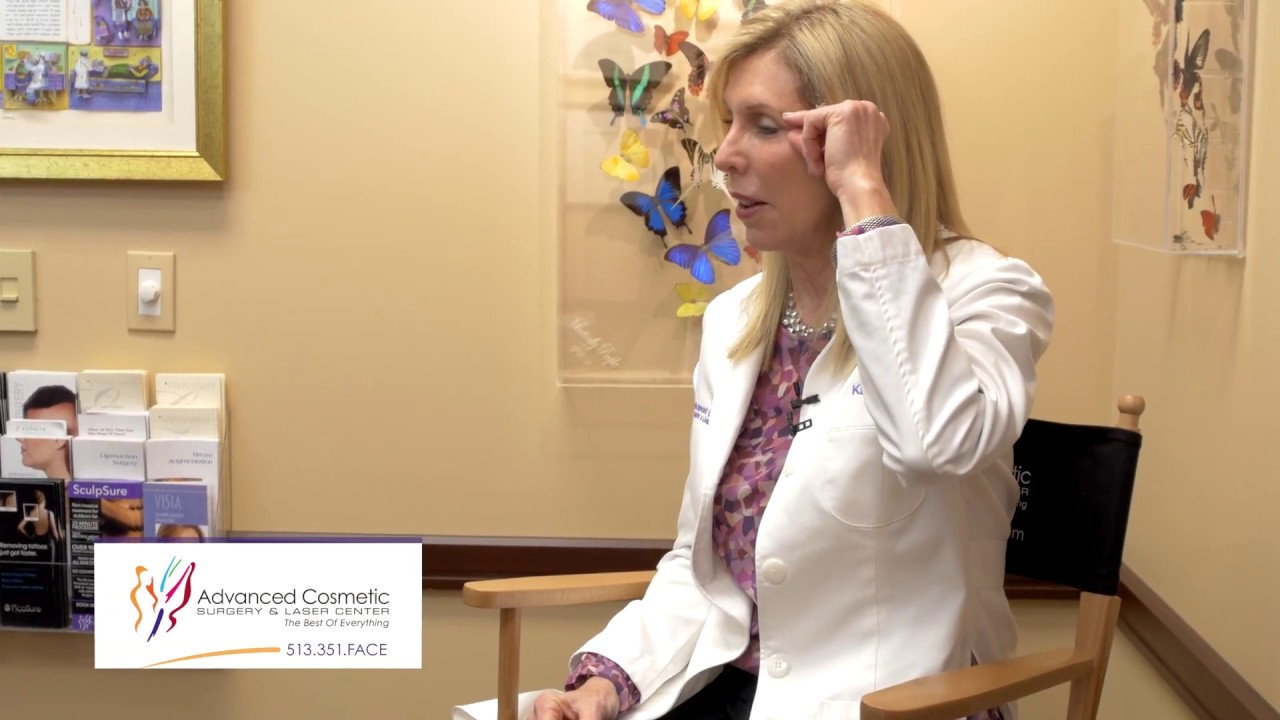 Best Treatment of the Crow's Feet Region of the Eyes.