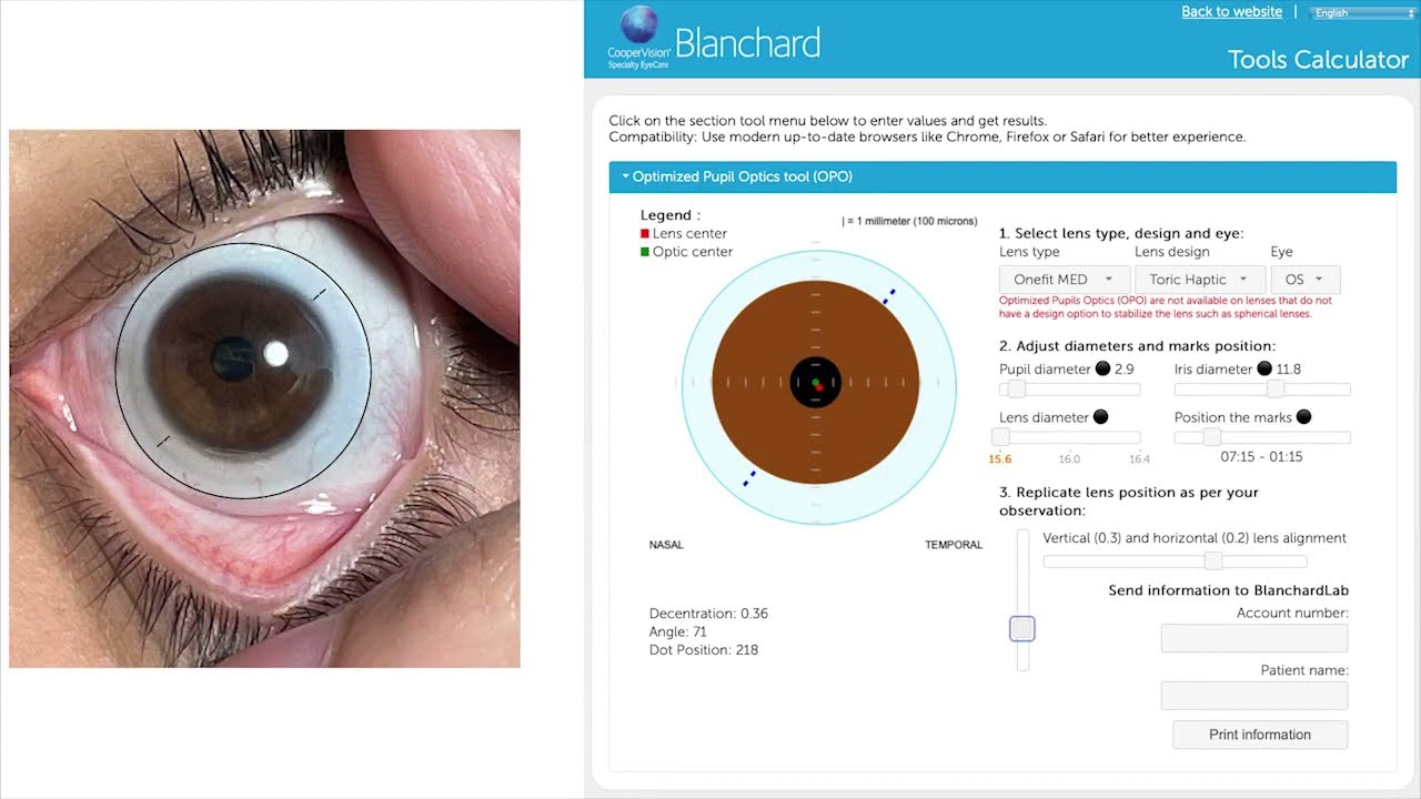 Using the Optimized Pupil Optics Online Fitting Tool