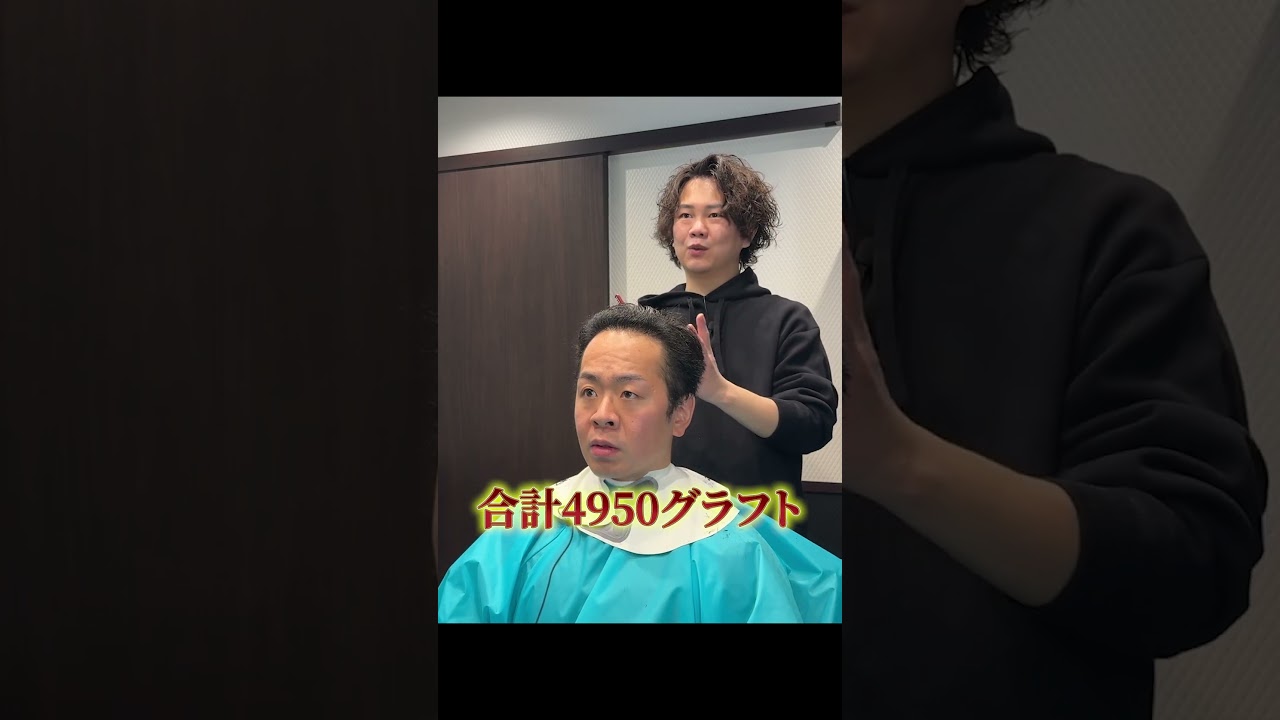 23歳から薄毛で地獄&rarr;植毛とヘアセットで大変身 #shorts