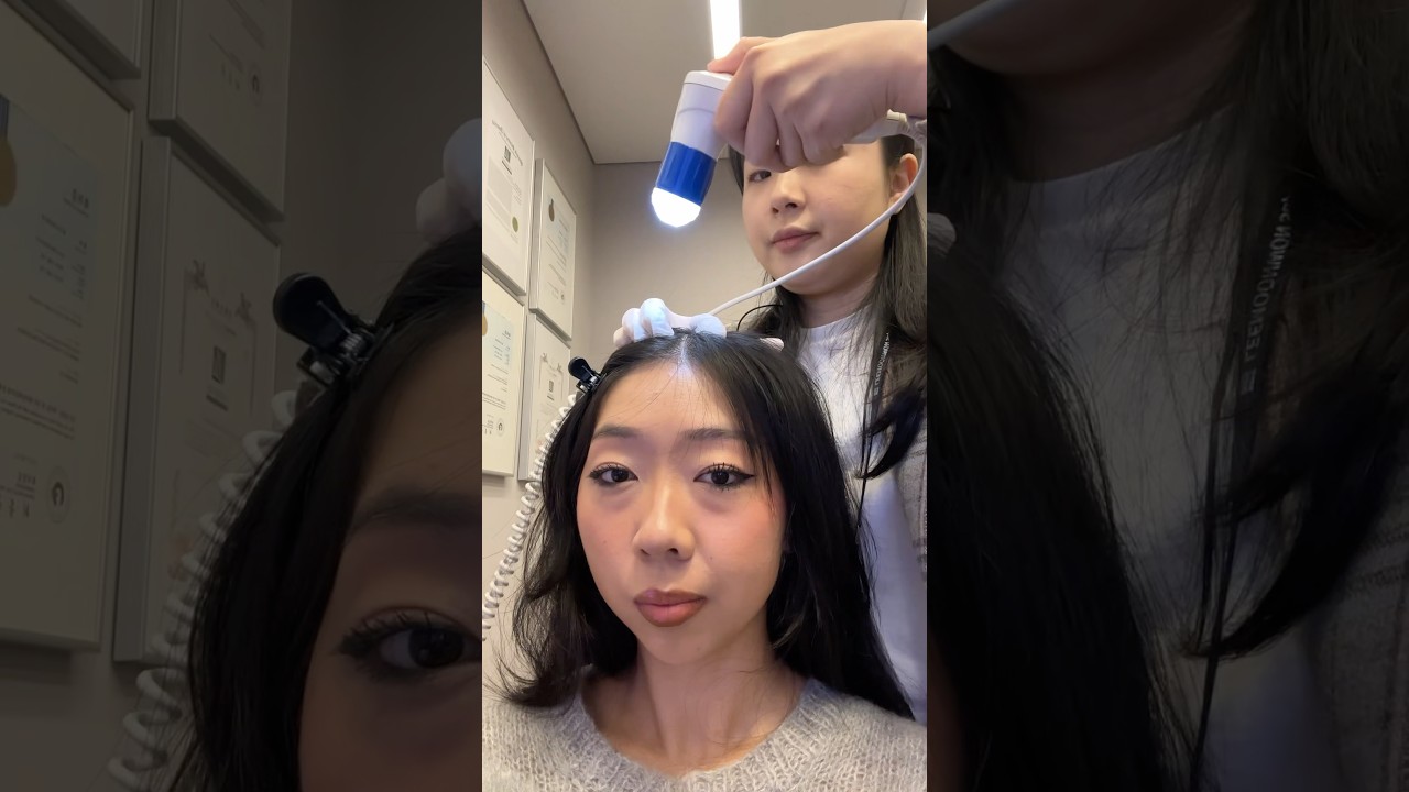 getting a korean scalp treatment for my scalp eczema??