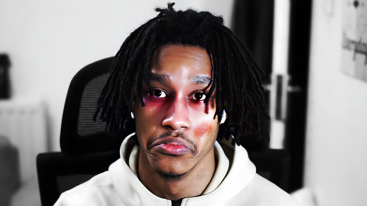 i got beat up...