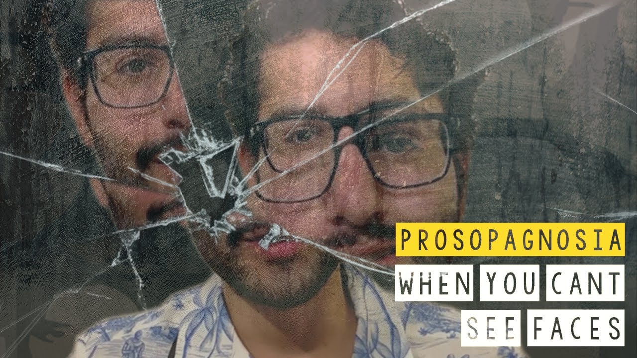 PROSOPAGNOSIA: The Truth About 
