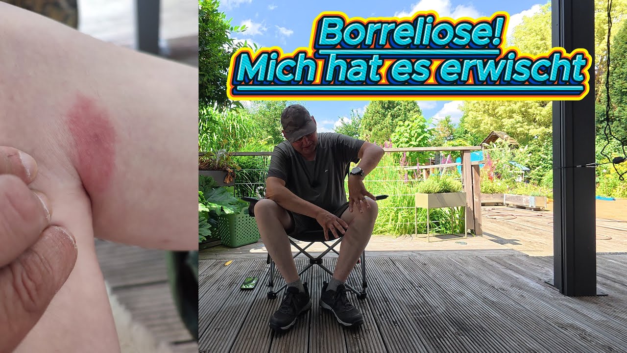 Borreliose-Mich hat es erwischt!