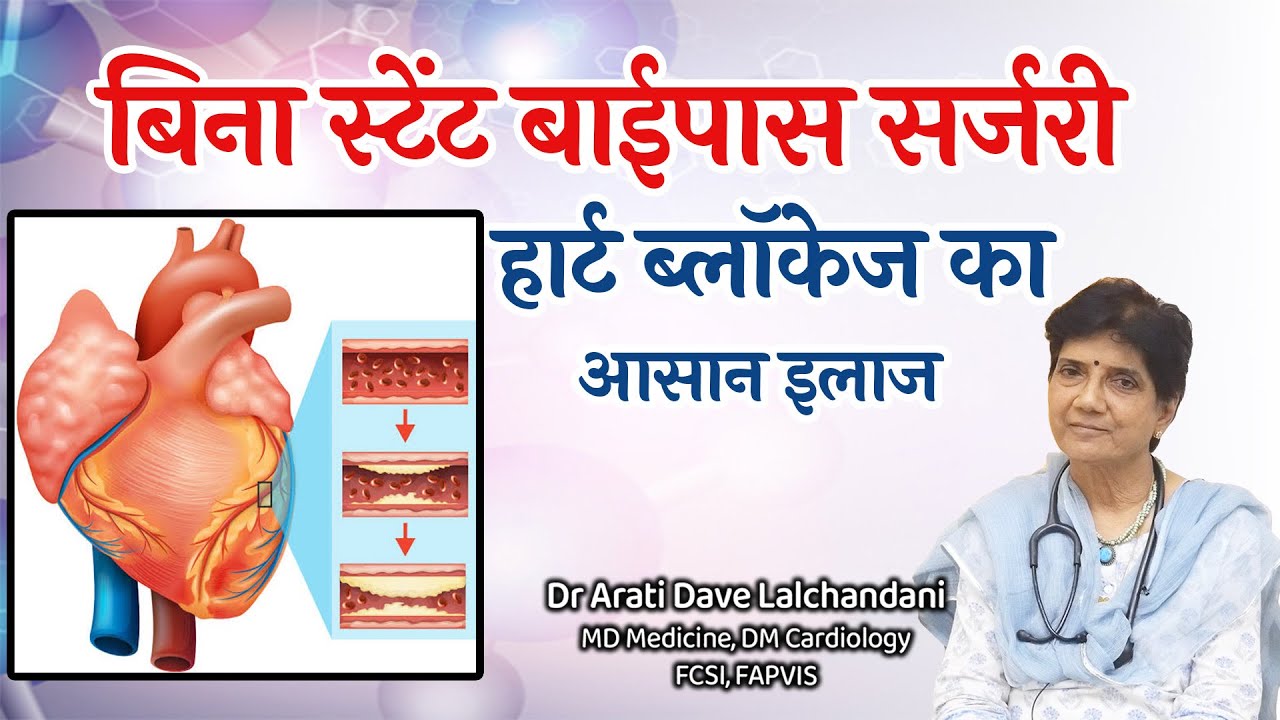 Heart Blockage: बिना स्टेंट बाईपास सर्जरी के भी हो सकता है इलाज... Dr Arati Dave Lalchandani
