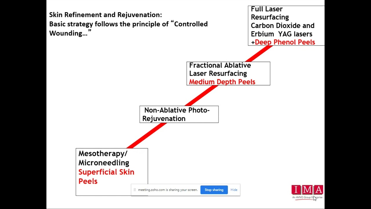 Webinar on Peels - Presented by Dr. Azaiba Kara