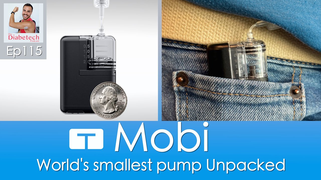 Mobi - The World's Smallest Hybrid Pump Unpacked - Ep 115