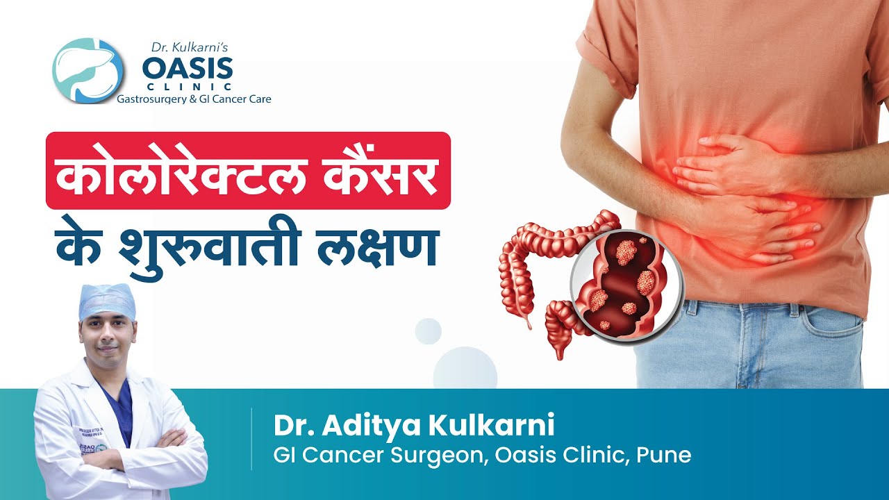 कोलोरेक्टल कैंसर के शुरुवाती लक्षण | Common Symptoms of Colon Cancer in Hindi | Dr. Aditya Kulkarni
