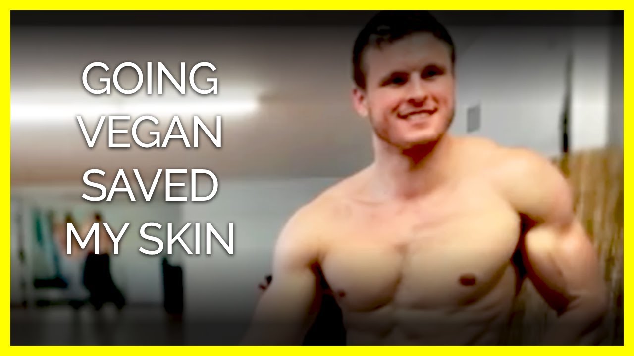 Going Vegan Cleared my Acne | Body Builder Brian Turner