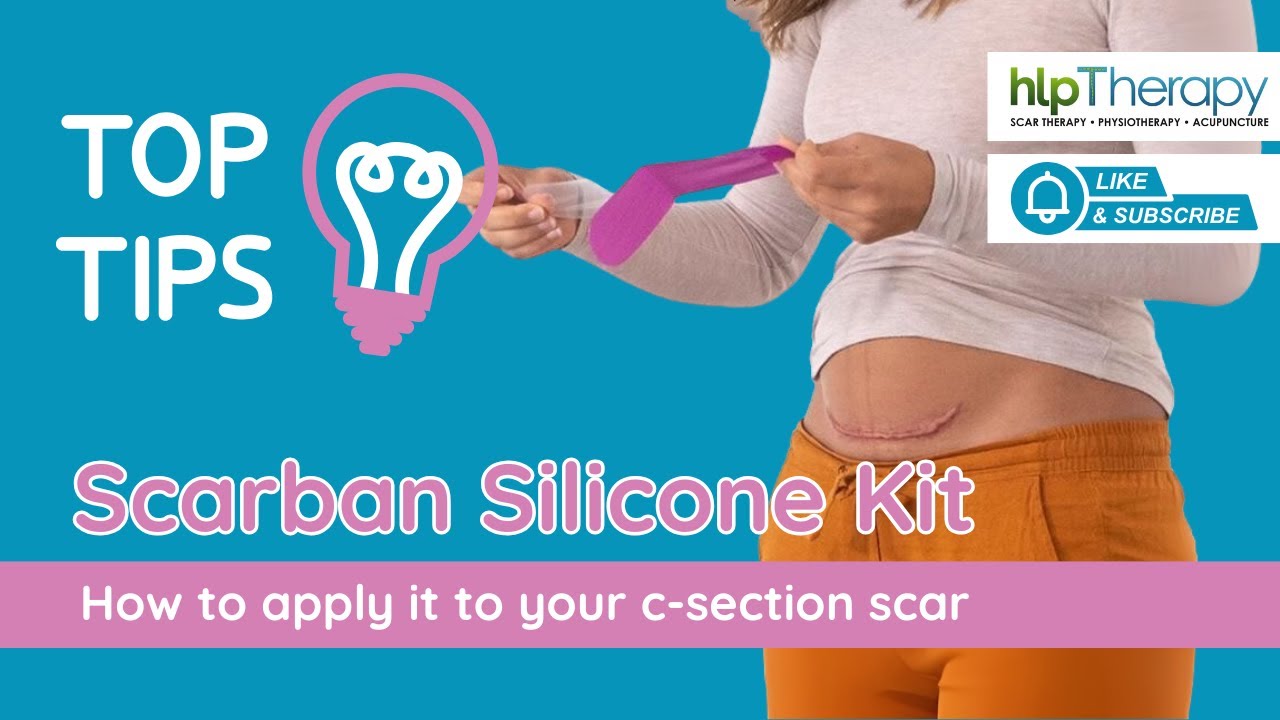 🔍 How to Apply Your Scarban Silicone Strip | Hannah from HLP Therapy Explains