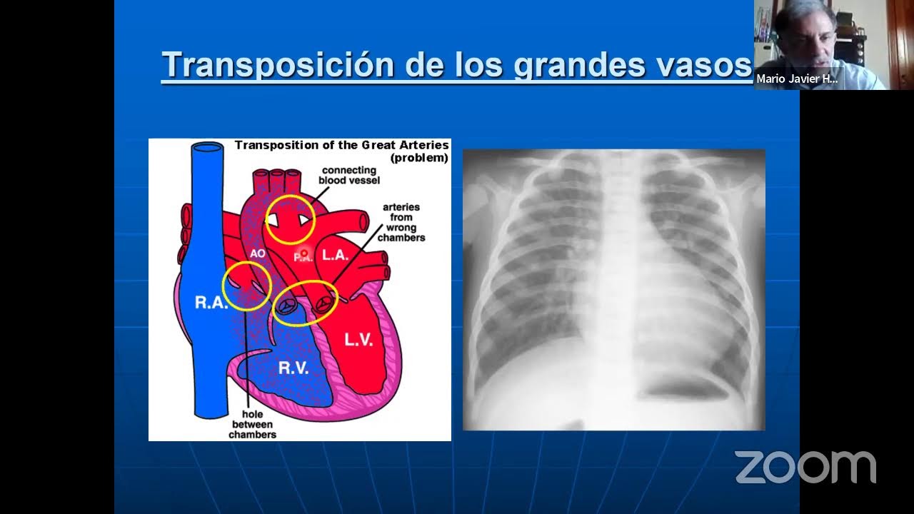 PARALELO DE EMBRIOLOGÍA - DESARROLLO DEL SISTEMA CIRCULATORIO