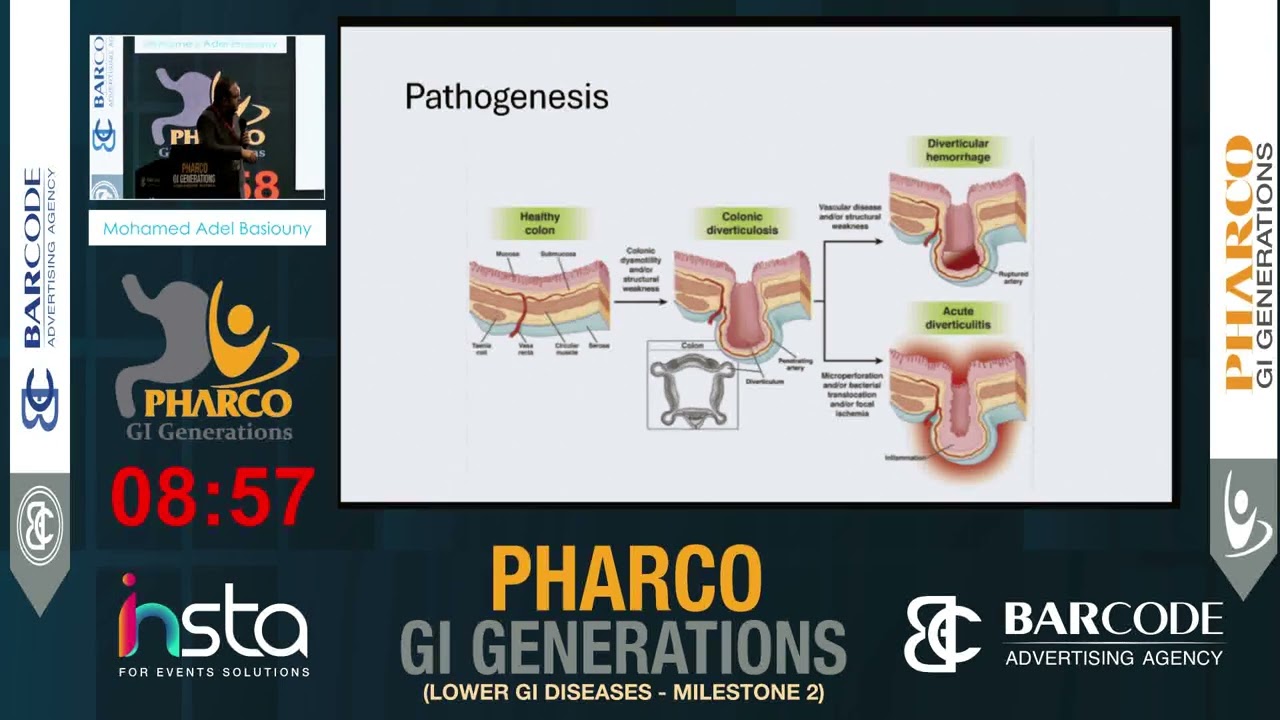Module 3 - Diverticular disease of the colon - Mohamed Adel Basiouny