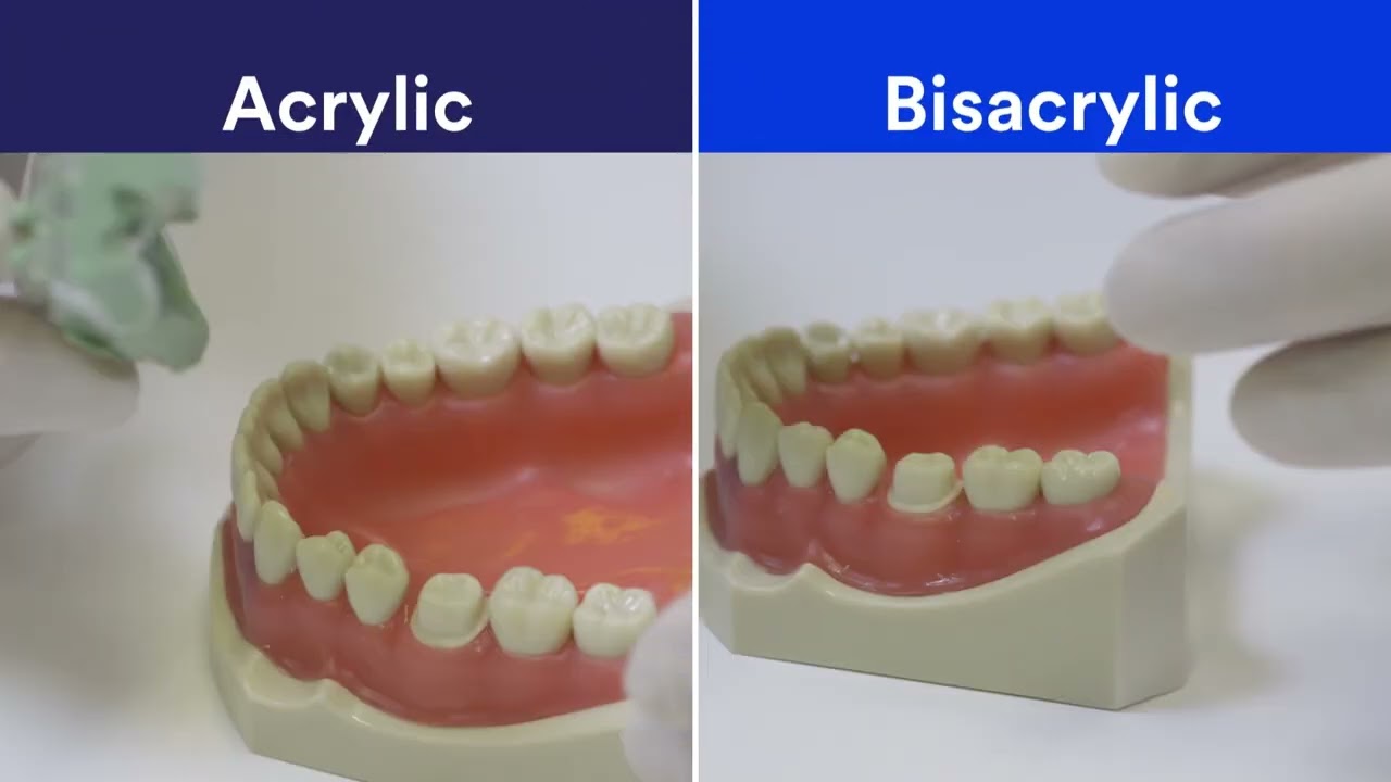 Protemp  4 Temporisation Material - Why Bisacrylic?
