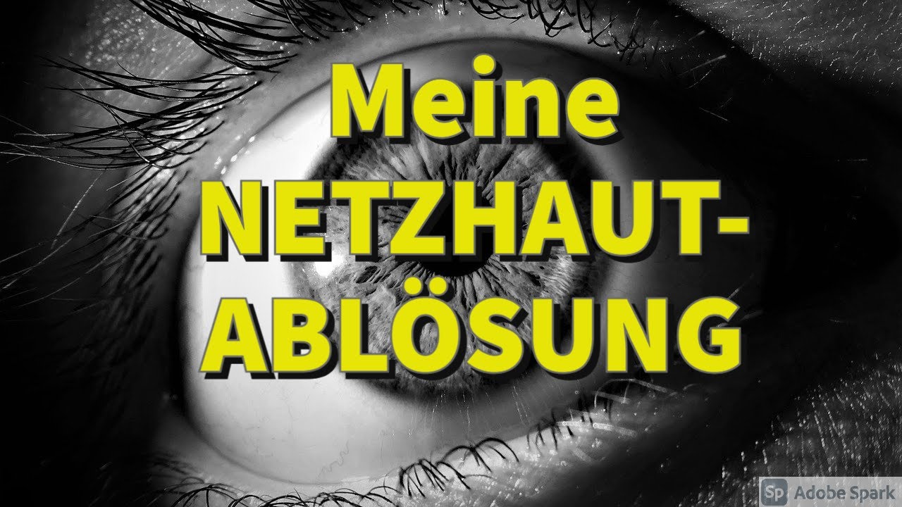 Meine NETZHAUTABLÖSUNG!