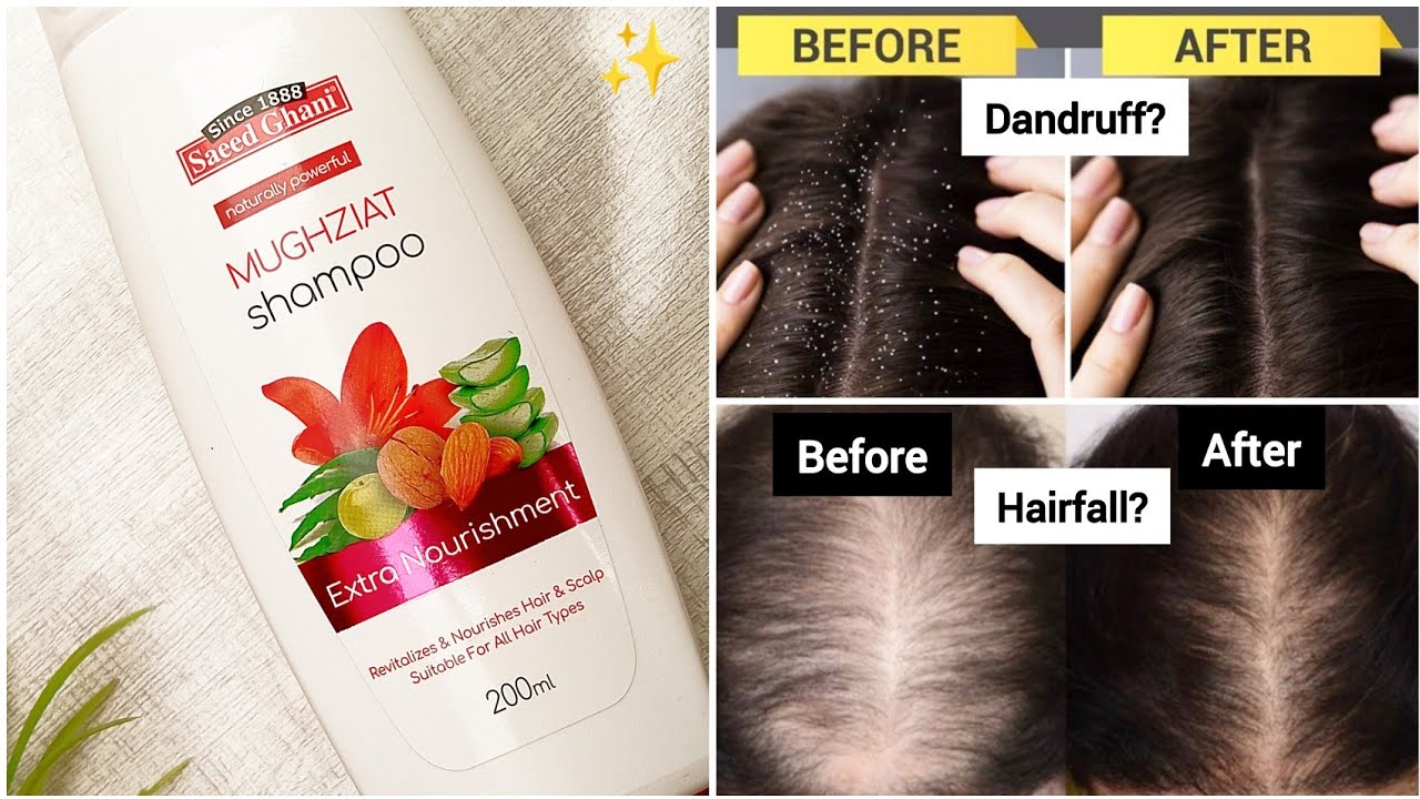 🔥 Saeed Ghani Mughziat Shampoo Honest Review | Dandruff & Hair Fall Solution? |