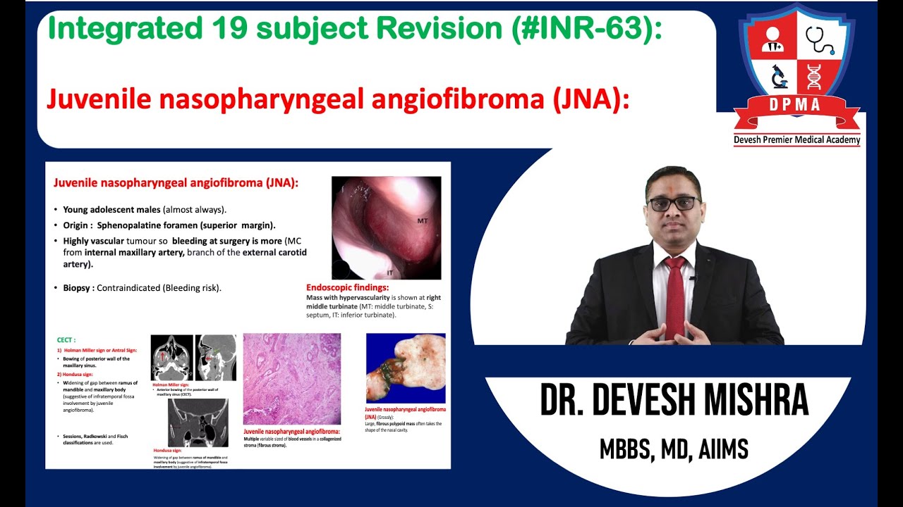 🕉 Integrated19 subject Revision (#INR-63):Juvenile nasopharyngeal angiofibroma by Dr. Devesh Mishra.