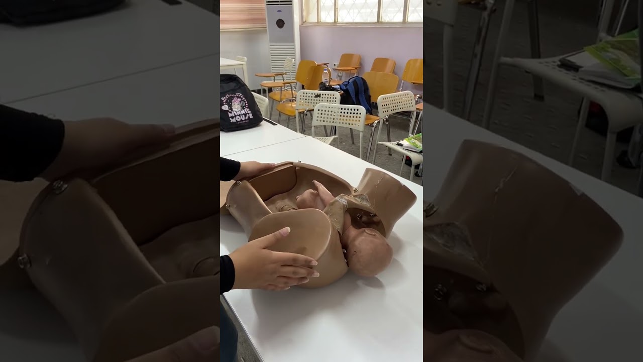 Skill Lab 6 : Practice shoulder dystocia & breech delivery (1)