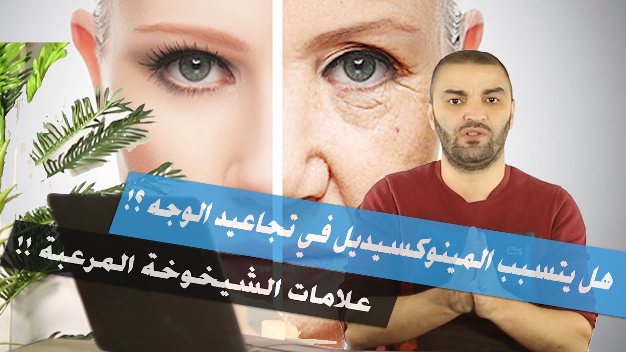 تجاعيد الوجه بسبب المينوكسيديل  | الشيب والشعر الابيض بسبب المينوكسيديل