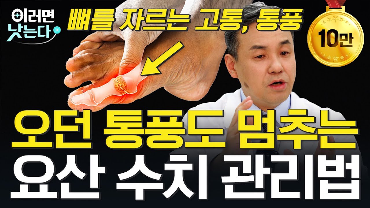 '퓨린 피하기 만큼 중요합니다' 당신이 몰랐던 통풍의 근본적 치료법ㅣ이은봉 서울대병원 류마티스내과 [이러면 낫는다ㅣ통풍]