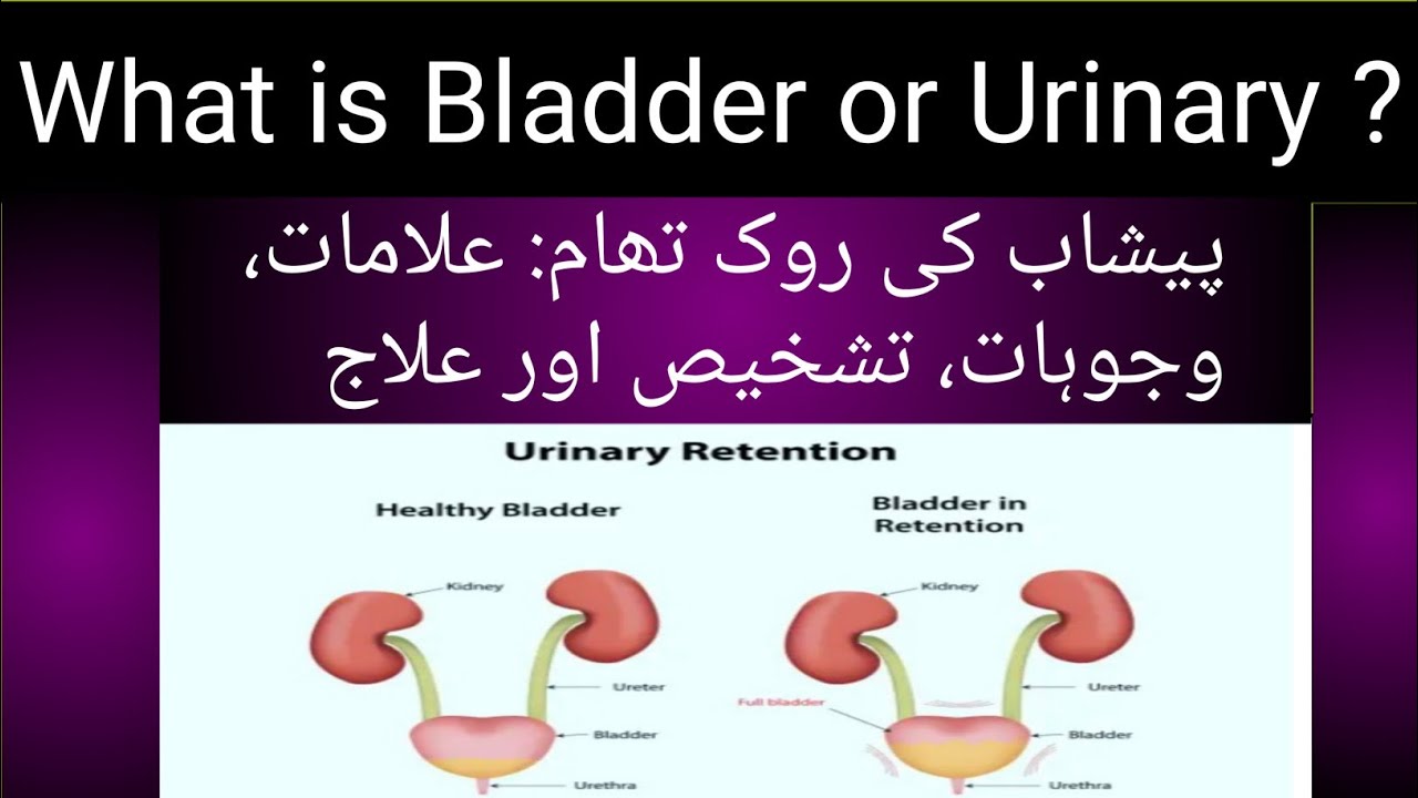 Pishaab khul ke Na Ana / Urinary system problem