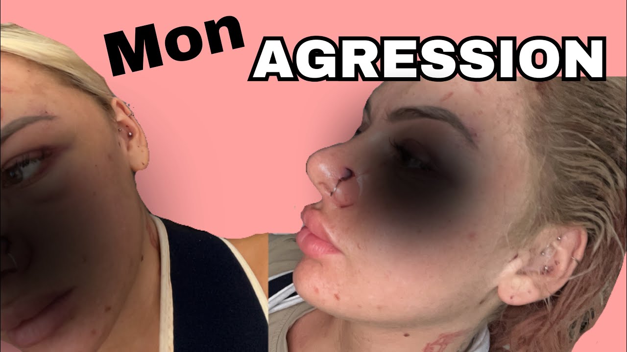 MON AGRESSION.