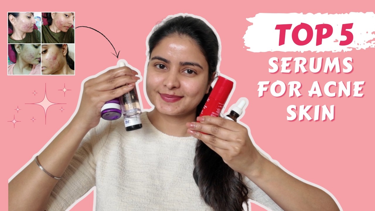 Top 5 serums for Acne Marks, Spots, Pigmentation & dark circles !