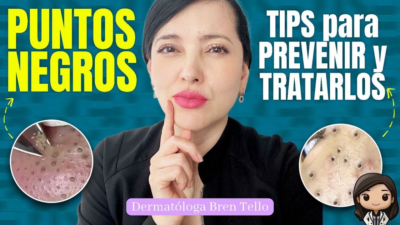 ¡ADIÓS PUNTOS NEGROS! COMO TENER LA NARIZ LIMPIA Y SANA 👩🏻‍⚕️ Tips de una Dermatóloga 
