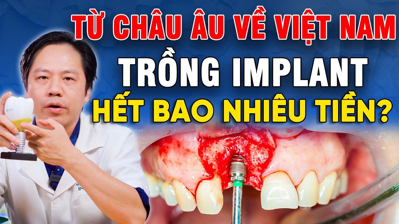Từ CHÂU ÂU VỀ VIỆT NAM trồng implant HẾT BAO NHIÊU TIỀN | Bác sĩ Vinh tư vấn chi tiết quá trình