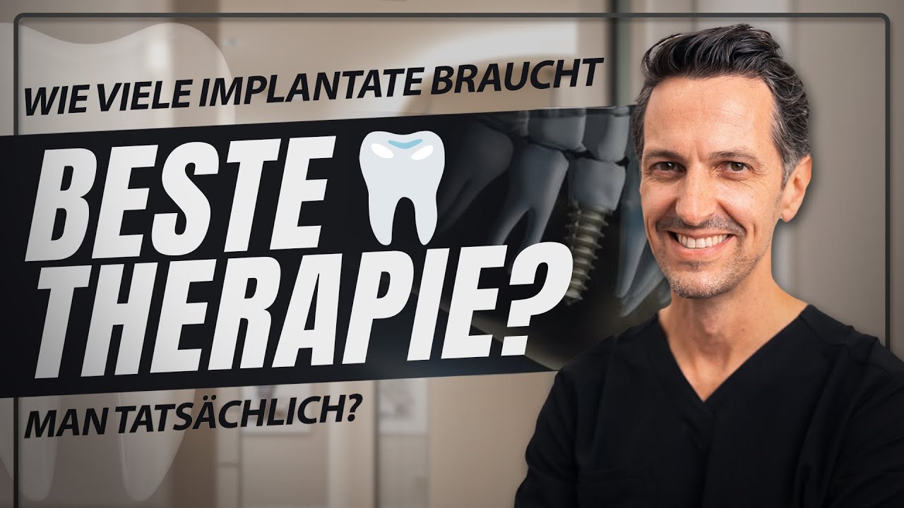 Wie viele Zahnimplantate brauchst du wirklich? - So findest du die perfekte Lösung!
