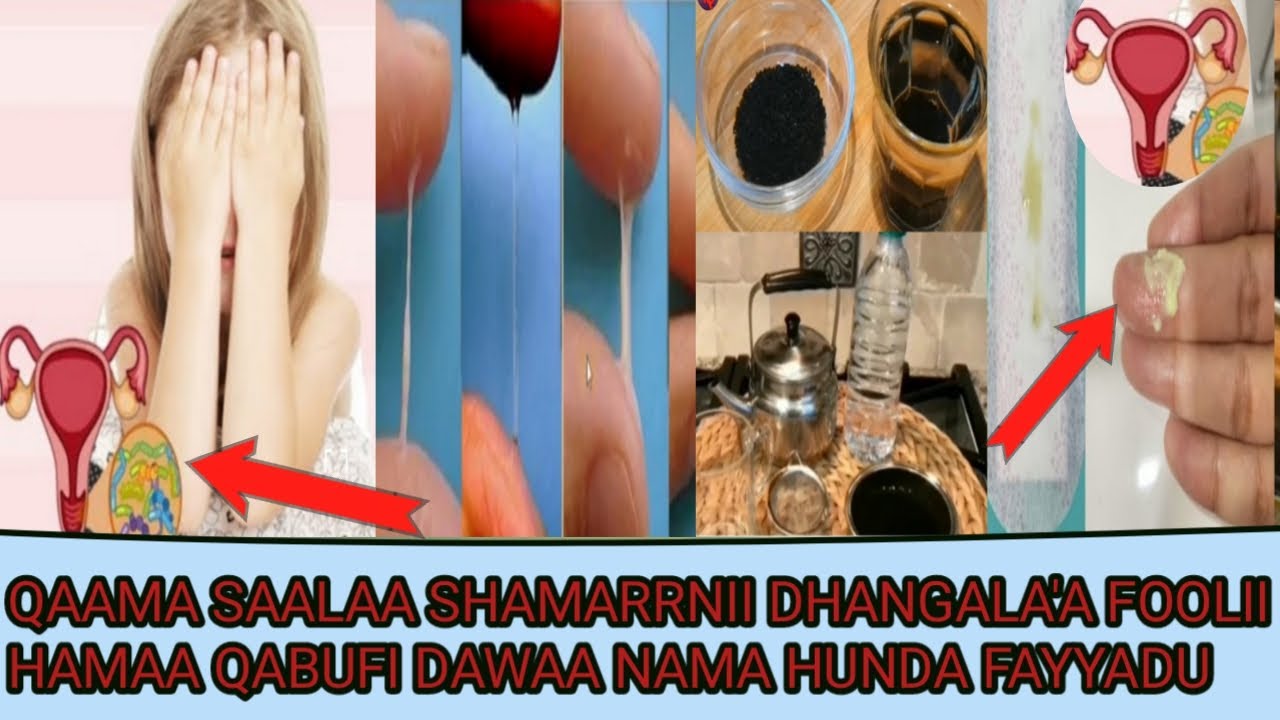 QAAMA SAALAA SHAMARRNII DHANGALA'A FOOLII HAMAA QABUFI DAWAA NAMA HUNDA FAYYADU
